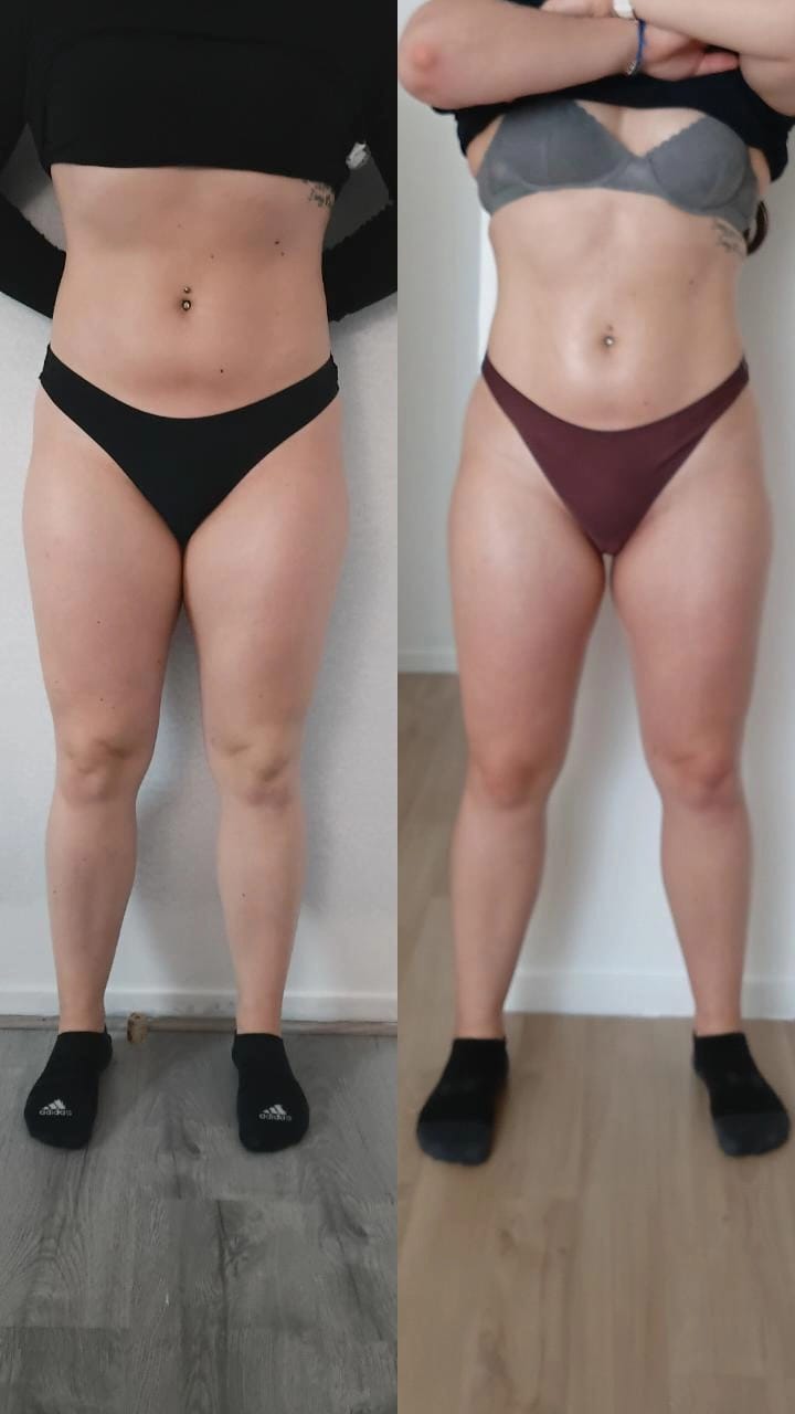 Résultat avant après soin Dianita Massages